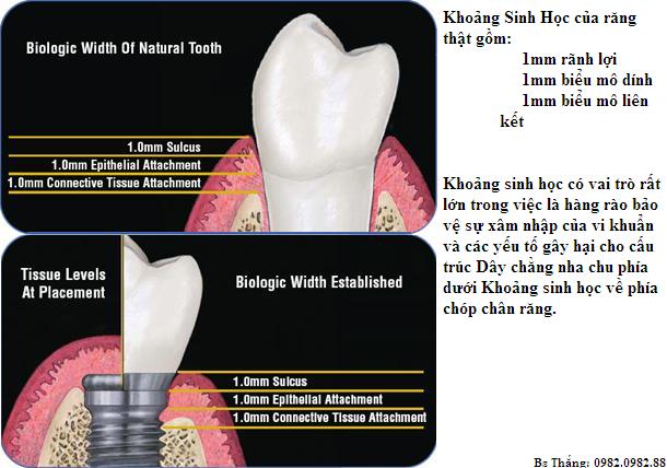 Khoảng sinh học quanh răng