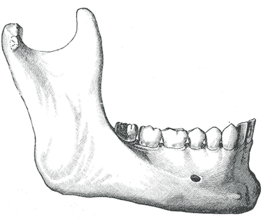 Giải phẫu xương hàm dưới